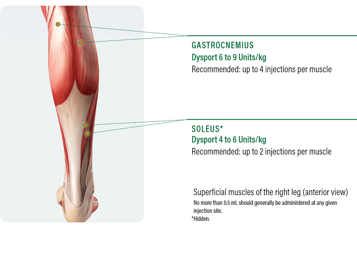 Dysport® Pediatric Spasticity Dosing & Administration Data